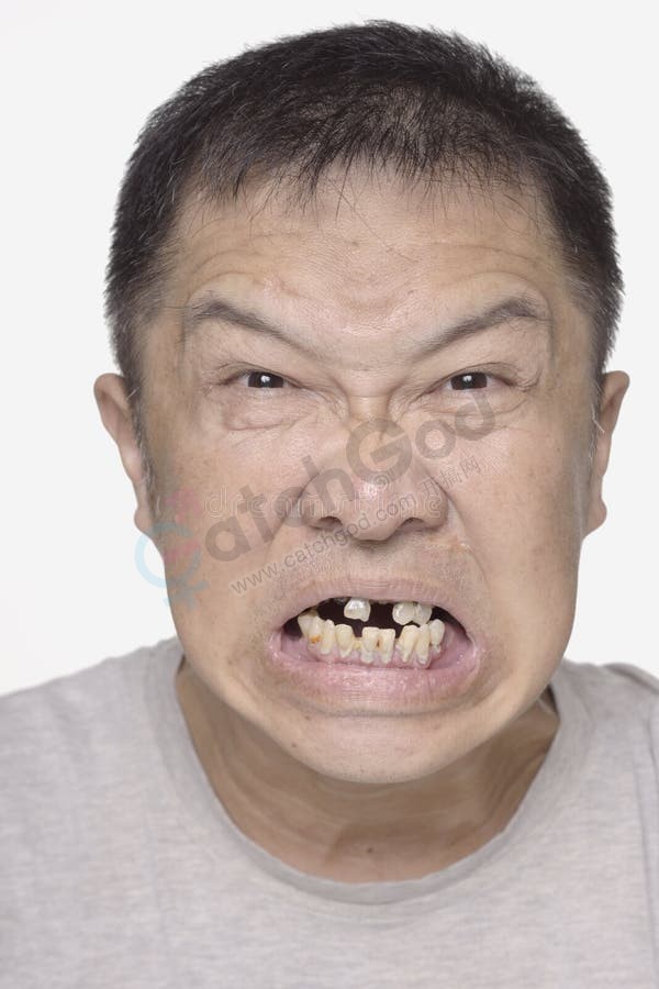 angry-chinese-man-bad-teeth-portrait-angry-chinese-man-bad-teeth-portrait-eyes-c.jpg